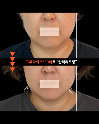 매장 제공 관리 전후 비교사진 첫 번째 사례