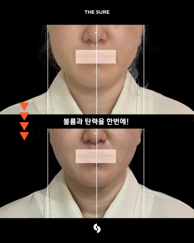 매장 제공 관리 전후 비교사진 두 번째 사례