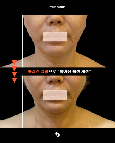 매장 제공 관리 전후 비교사진 세 번째 사례